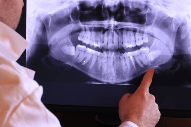 Best Weekend Emergency Dentist in Canon, GA